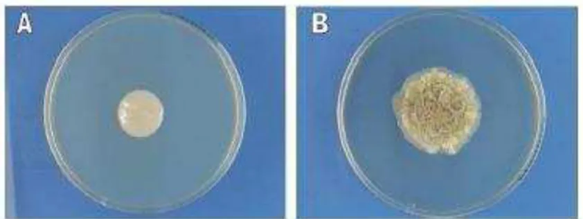 Figura 2. Colônias de Trichosporon em placa de meio SDA à 37ºC: após 96 horas, lisas  (a),  e  após  45  dias,  cerebriformes  (b)