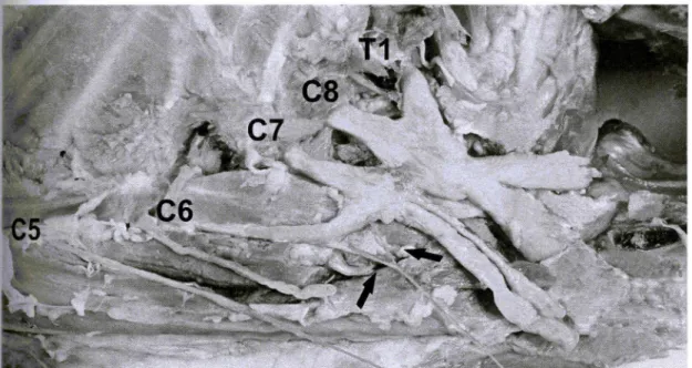 FIGURA 1O-Terçodistal da região cervical (vista lateral esquerda) de ovino da raça Santa Inês (Obs