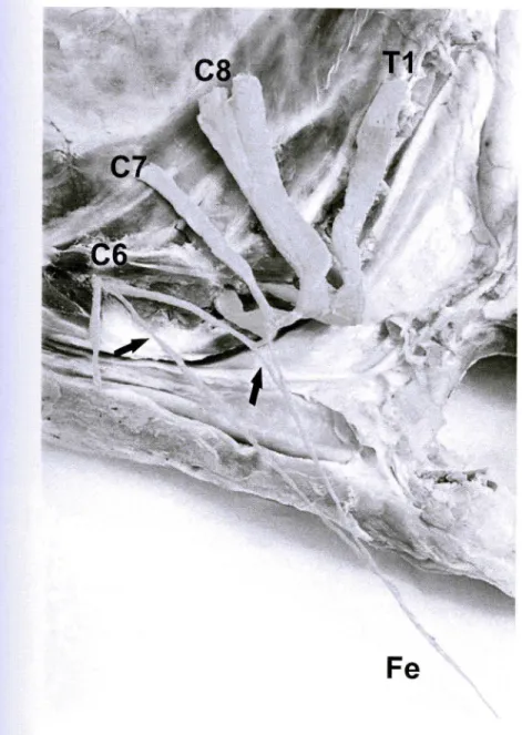 FIGURA 11 -Terço distal da região cervical (vista lateral esquerda) de ovino da raça Santa Inês (Obs