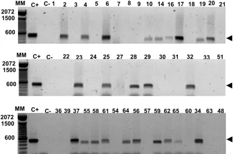 Figura 6 - Eletroforese em gel de agarose dos produtos da amplificação do DNA de  pecíolo de citros infectados ou não com Xylella fastidiosa por PCR utilizando  os iniciadores específicos CVC-1 e CVC 272-2int
