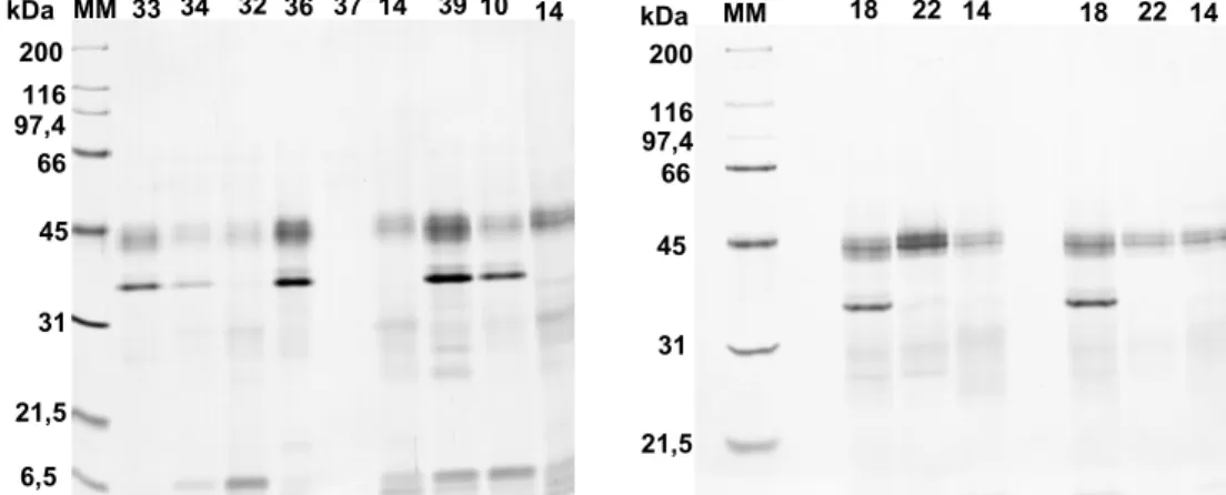 Figura 9 – Perfil de proteínas do FI de folhas de laranjeira em géis de poliacrilamida (15%)  desnaturantes