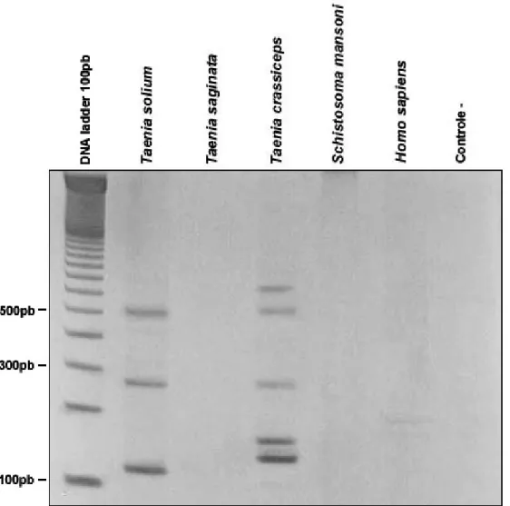 Figura 7 – Avaliação da especificidade da PCR. Cada uma das canaletas  mostra o perfil de amplificação obtido para as diferentes amostras