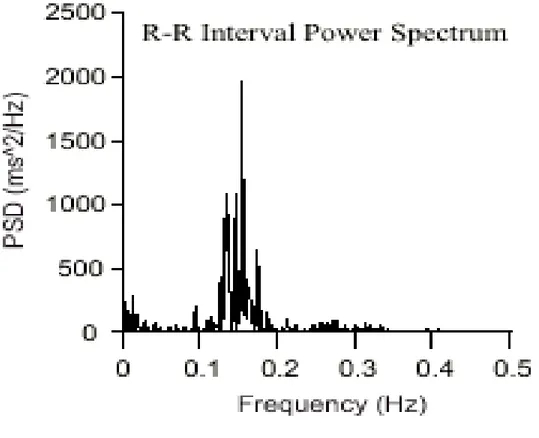 Figura 3 -  Divisão dos componentes espectrais em bandas de frequência