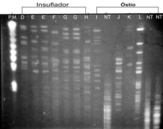 Figura 1 – Perfis de restrição (PFGE) do DNA das cepas resistentes à oxacilina com utilização da enzima de  restrição SMAI  