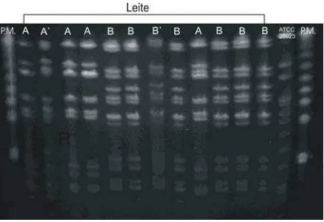 Figura 2 – Perfis de restrição (PFGE) do DNA das cepas provenientes de amostras de leite mastítico bovino  das fazendas A e B com utilização da enzima de restrição SMAI 