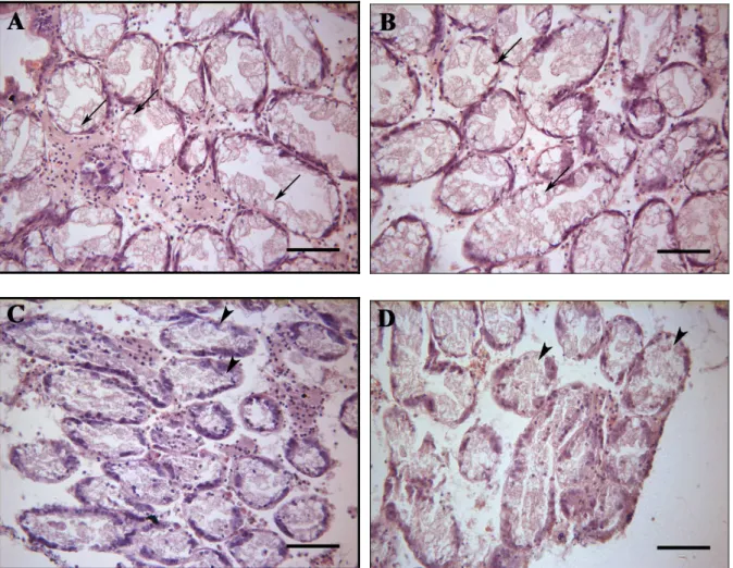 Fig. 14 - Histological sections stained with haematoxylin and eosin of digestive gland of  C