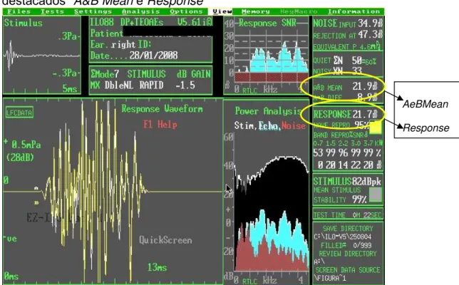 Figura 1: Exemplo de tela da captação das EOAT, na qual encontram-se  destacados “A&amp;B Mean e Response” 