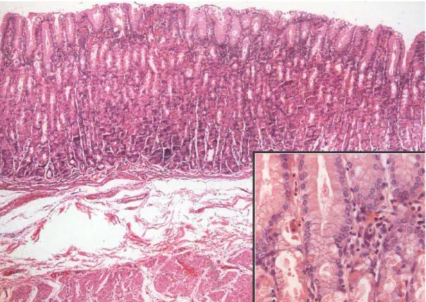 Figura 5: Mucosa gástrica de padrão fúndico normal. H/E 5x. Detalhe  ressaltando a região do colo glandular H/E 40x&#34; 