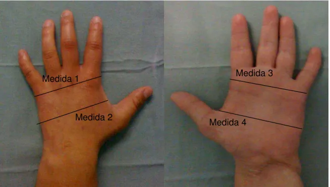 Figura 10 - Dimensões medidas nas mãos espalmadas e suas respectivas denominações. 