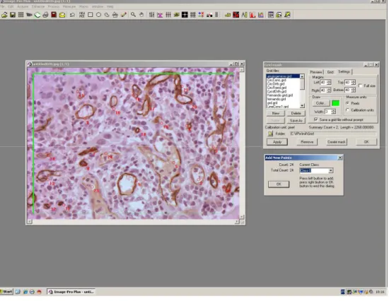 Figura  2.  Imagem  obtida  no  programa  após  a  inserção  de  grades  de  correção para   contagem dos microvasos (magnificação de 200X) 