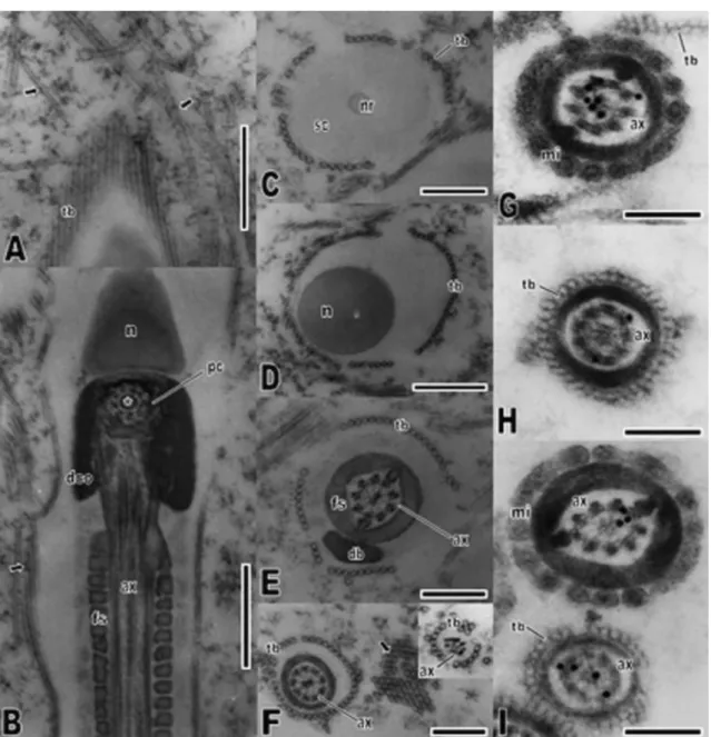 Fig. 4.  Transmission electron micrographs of tannic acid treatment and immunolocalization of tubulins  in  Crotallus  durissus  spermatozoon