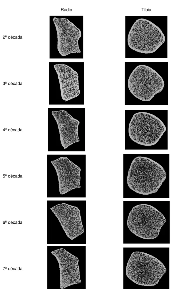 Figura 2 - Imagens em 3D do rádio distal e da tíbia para cada década analisada 