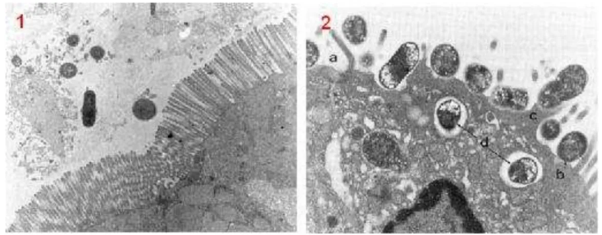 Figura  01.  Microvilosidades  intestinais  intactas  (1)  e  lesão  “attaching/effacing”  no  microscópio eletrônico (15.680x) (2)