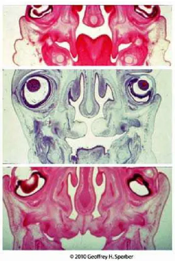 Figura 4. Embriões de sete, oito e nove semanas (de cima a baixo, respectivamente)  ilustrando a elevação e fusão das placas palatinas (Sperber GH, Sperber SM e Guttmann 