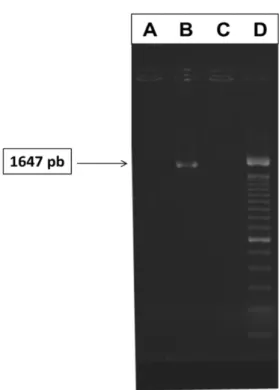Figura  2  – Eletroforese dos produtos de PCR correspondentes ao  gene  hexon do HEV. Coluna A: 