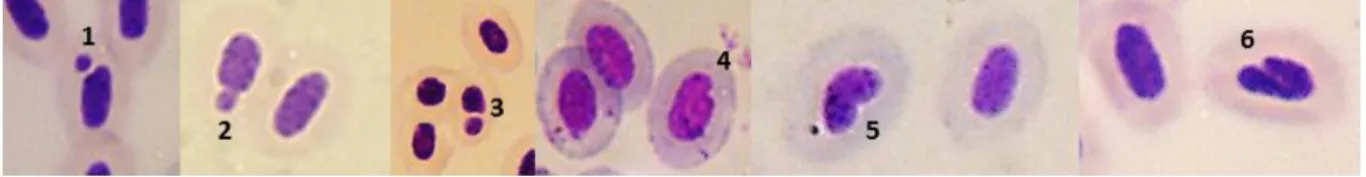 Figura 3. Fotografias de micronúcleo e diferentes tipos de anormalidades nucleares em eritrócitos de Danio rerio  no  presente  trabalho:  micronúcleo  (1),  broto  (2),  célula  binucleada  (3),  “blebbed”  (4),  “lobed”  (5)  e “notched” 