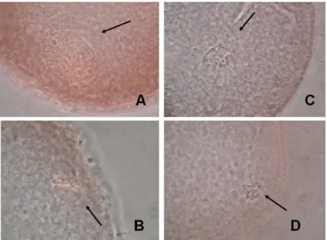 Figura  2.2.  Ovócito  em  VG  (A);  Ovócito  MII  (B);  Ovócitos  com  cromatina  anormal  (C);  Ovócitos  com  cromatina  degenerada  (D)