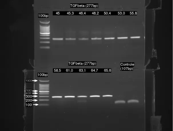 Figura 2-   Imagem referente ao gel de agarose 1,5% corado com brometo  de etídio - Primer TGF - beta após amplificação por PCR na fase  de padronização da reação