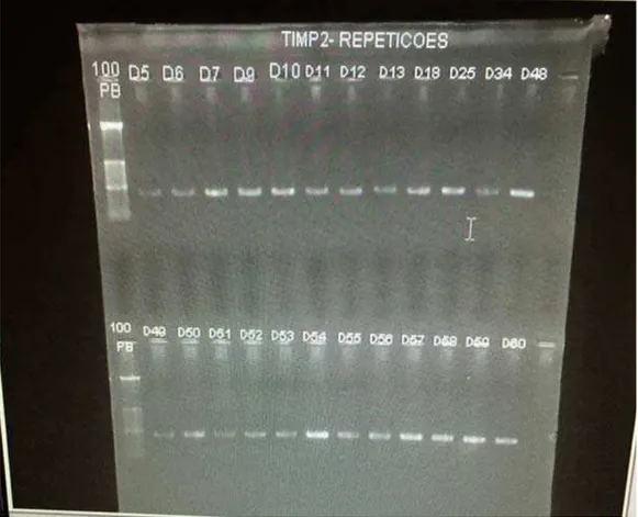 Figura 5 -   Imagem referente ao gel de agarose 1,5% corado com brometo  de etídio -Primer TIMP 2 após amplificação por PCR na fase de  amplificação protocolo Hotstart Mix das amostras