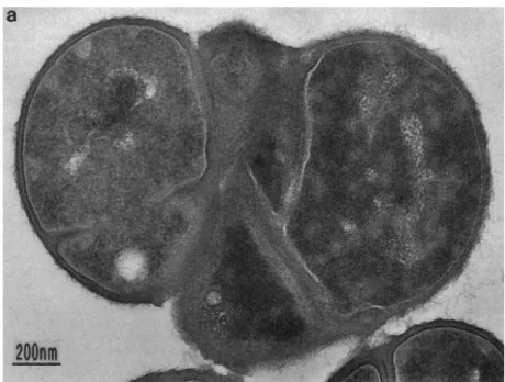 Figure 5 – Thin section of  S.  aureus  femA mutant, displaying cells with  irregular septa  and  defects in cell separation