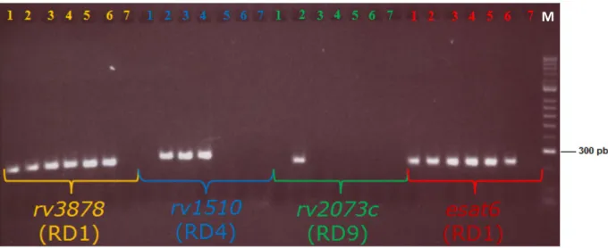 Figura 3.3. Ilustração do resultado de uma electroforese em gel de agarose para determinação da presença ou  ausência das RD1, RD4 e RD9 num conjunto de estirpes micobacterianas seleccionadas: M