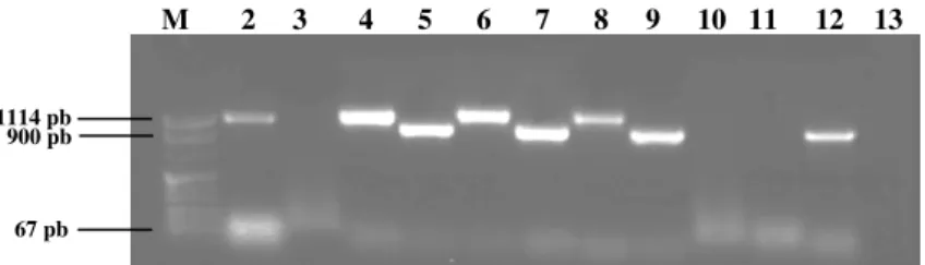 Figura 8 –  Electroforese em gel de agarose do fragmento interno do gene bla TEM , amplificado por PCR com  os primers FIN e DEB