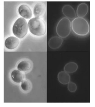 Fig. 3. Subcellular localization of Gxs1–GFP. Phase-contrast (left panel) and epifluorescence (right panel) images are shown of S.