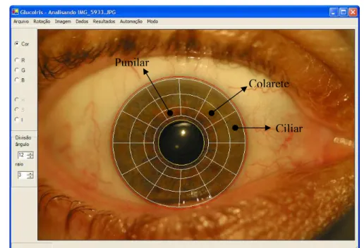 Figura 2.9 – Tela principal do programa de extração de dados da coloração de 36  regiões da íris