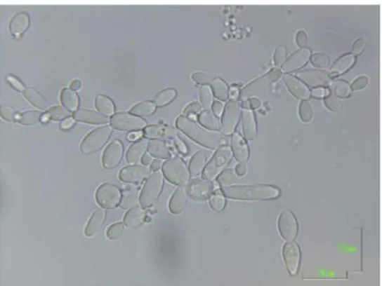 Figure 1.4  –  Morphological differences  of  Brettanomyces spp. under optical microscope  observation at 1000x amplification (Suárez et  al., 2007)