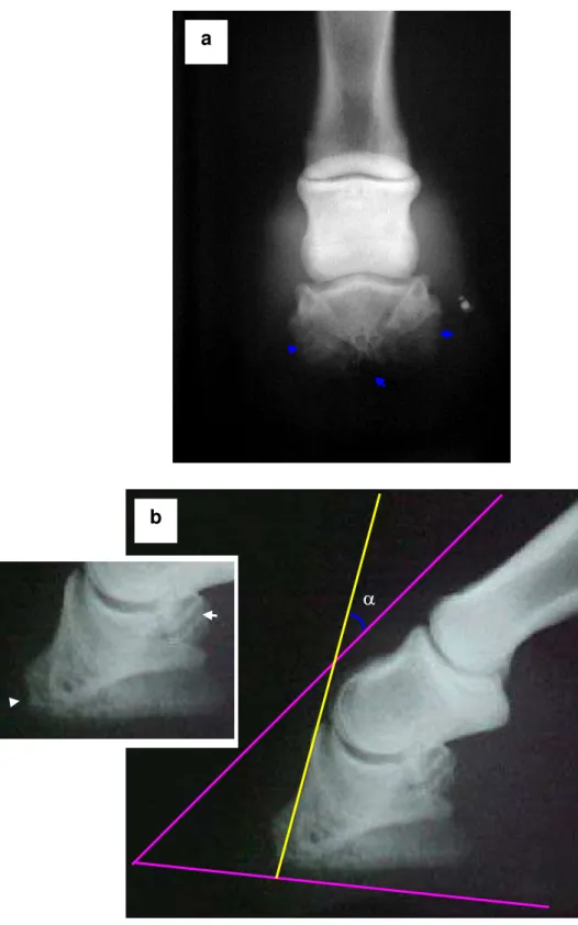 Figura 13 – Fotografia de radiografia em projeção dorsoproximal-palmarodistal com  ângulo de 65º da região distal do membro direito de um asinino (a),  demonstrando osteíte severa associada à destruição óssea da falange  distal (cabeças de seta azuis) e la