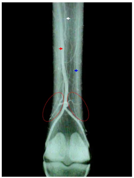 Figura 15 – Fotografia de radiografia em projeção dorso-palmar da região distal do  membro torácico direito de um asinino evidenciando o aspecto  angiográfico da artéria digital palmar comum (cabeça de seta vermelha)  e das artérias metacárpicas palmares I