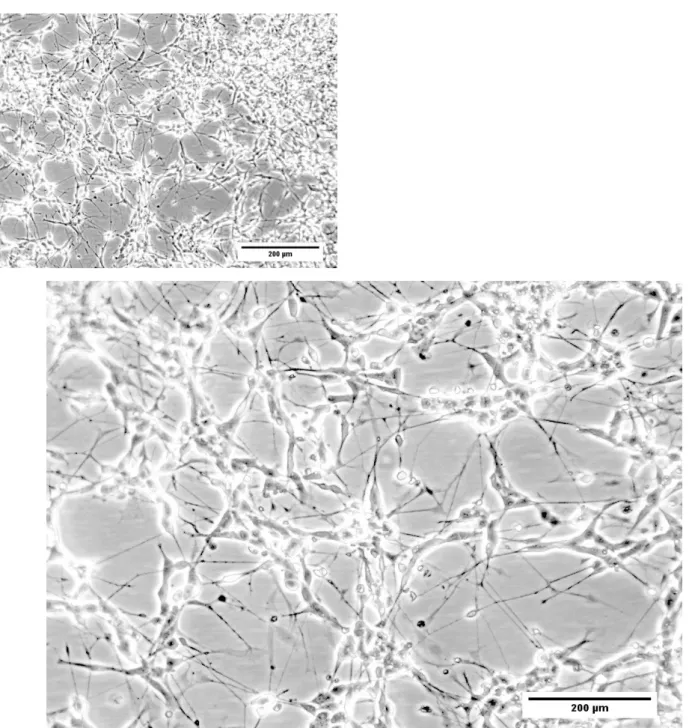 Figure  11.2  -  Morphological  analysis  of  SH-SY5Y  cells  during  neuronal  differentiation,  day  7