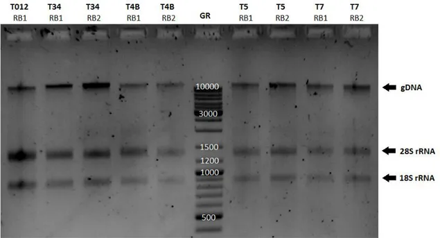 Figure  3.I  Separation  of  the  total  RNA  samples  extracted  from  P.  pinaster  embryos  in  a  1%  (w/v)  agarose  gel  stained  with  RedSafe™   (0.025ul/ml)