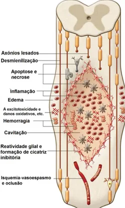 Figura 1.4- Eventos fisiopatológicos que ocorrem após lesão na espinal medula. Adaptado de [3]