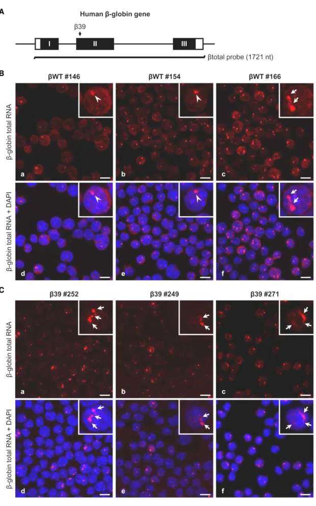 Figure  III.2  Beta-globin  transcripts  subcellular  localization  depends  on  the  presence  of  a  PTC and probably on the transgene copy number