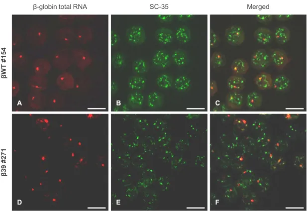 Figure  III.4  Beta-globin  transcripts  presenting  a  nuclear  speckled-like  pattern  do  not  colocalize with the SC-35 domains