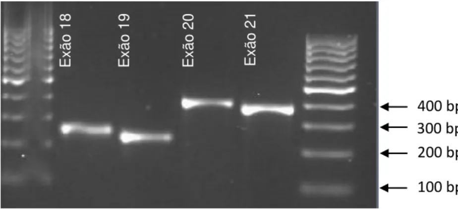 Figura  3.2-  Fotografia  dos  produtos  de PCR  obtidos  através  da  amplificação  das  amostras  de  sangue conservadas em Indicating FTA Micro Card