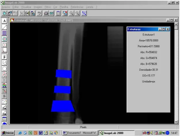 Figura  9  –  Imagem  do  programa  ImageLab  mostrando  os  três  quadriláteros  correspondentes  as  regiões DORM (metafisária), DOD1 (diafisária 1) e a DOD2 (diafisária 2) demarcadas e  a leitura da densidade óptica da região metafisária 