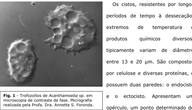 Fig. 1 - Trofozoítos de Acanthamoeba sp. em  microscopia de contraste de fase. Micrografia  realizada pela Profa