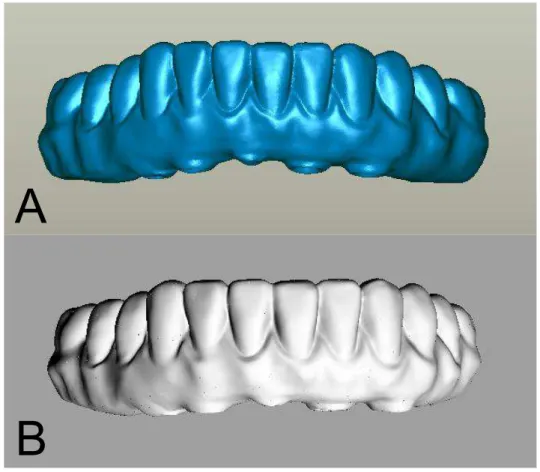 Figura 9. A – Imagem da supraestrutura obtida a partir da segunda “limpeza”, arquivos com  extensão “.stl”; B – Modelo sólido tridimensional finalizado