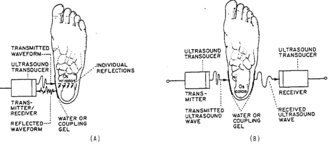 Fig. 2.13 - Técnicas experimentais de caracterização de tecido por ultra-som.