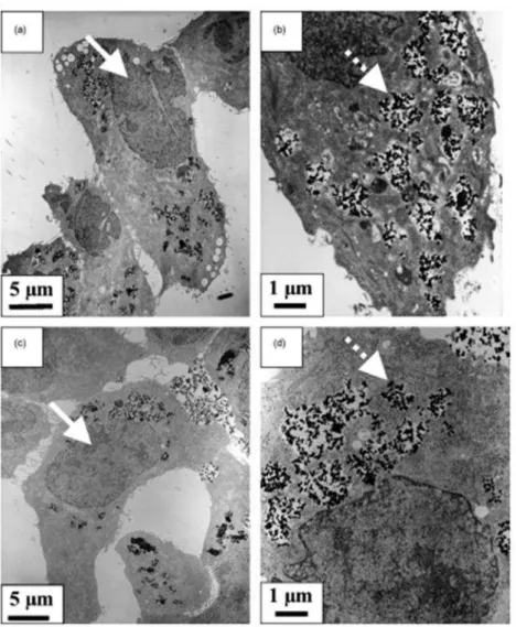 Fig. 3.3: Imagens de microscopia eletrônica de transmissão de células cancerosas fixadas 