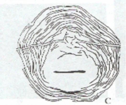 Figura 9. Corte da região perineal de fêmea  de Meloidogyne incognita. Fonte: 