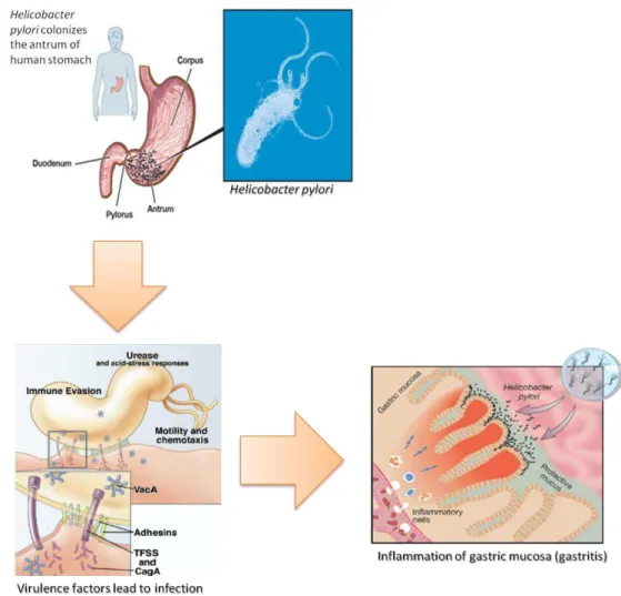 Figure 1.2.1 – H. pylori infection: Colonization and infection of the most distal part of the stomach,  the  antrum