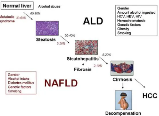 Figura 1.1- Representação esquemática do quadro de progressão da ALD e da NAFLD (Bataller,  2011)