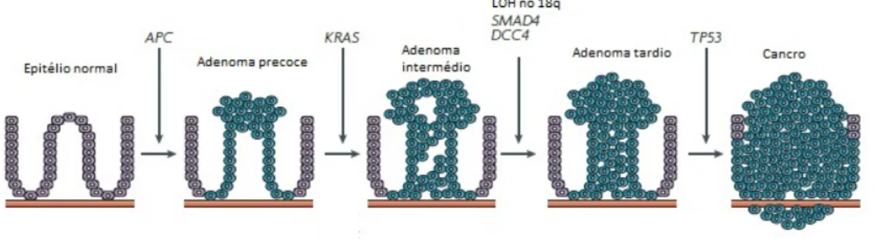 Figura 1.1: Sequência adenoma-carcinoma (adaptado de Walther et al., 2009)