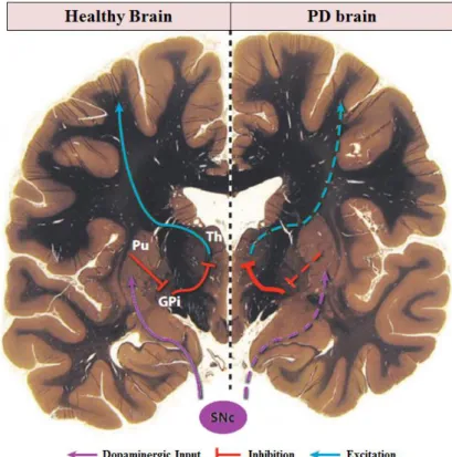 Figure 1.1: Schematic representation of the neurodegenerative processes affected in PD