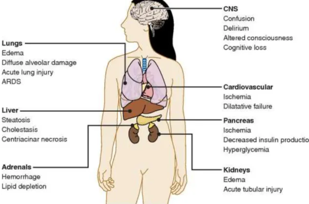 Figura 1.2 - Principais órgãos afectados e efeitos causados com o desenvolvimento  de sepsis