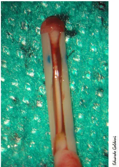 FIGURA  19:  Segmento  de  nervo  ciático  regenerado  ainda  dentro  do  tubo  (grupo controle)