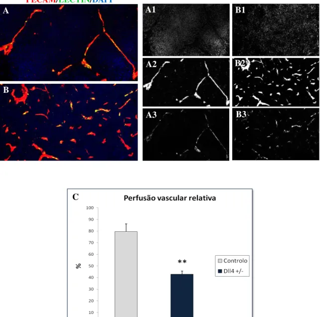 Figura nº 3.10 – Imagens de imunofluorescência relativas à perfusão vascular dos adenocarcinomas mamários  de ratinhos Her2